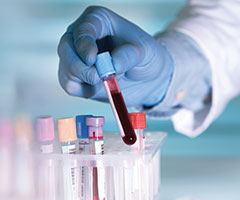 Blood sample for labs