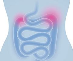 Inflamed bowel track image