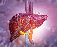 Liver disease graphic