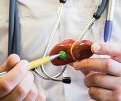 Gallbladder disease model