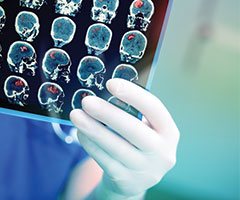 Person holding brain scans